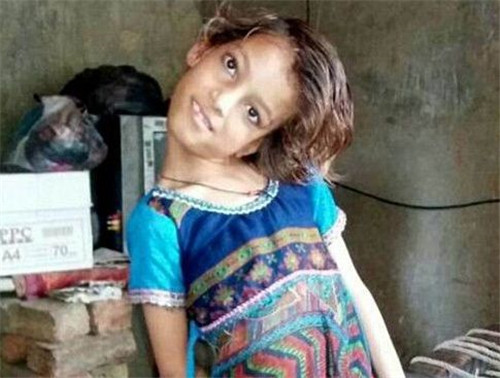 女孩头部无法竖立  被称为罪恶象征，村民害怕的瑟瑟发抖